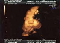 scan10012a